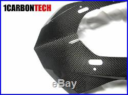 15-19 Yamaha Yzf R1 Full Carbon Fiber Nose, Tank, Side Trims And Intake Kit